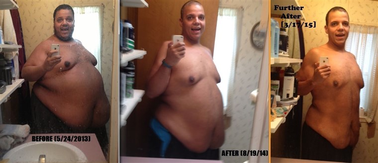 杰西 Shand weighed more than 650 pounds and lost more than 350 pounds with help from an online community.