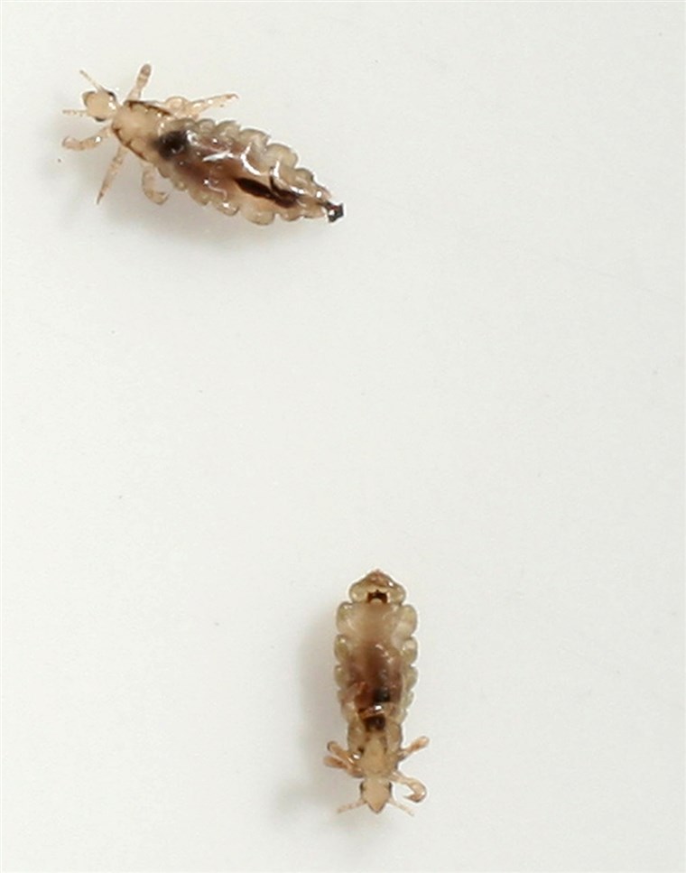 柏林 - JUNE 22: Two head lice (Pediculus humanus capitis) crawl on a piece of paper after having been removed from the hair of a little boy June 22...