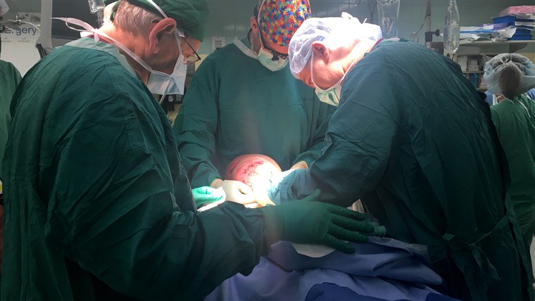 في a 12-hour surgery, doctors removed a 10 pound tumor from 14-year-old Emanuel Zayas face.