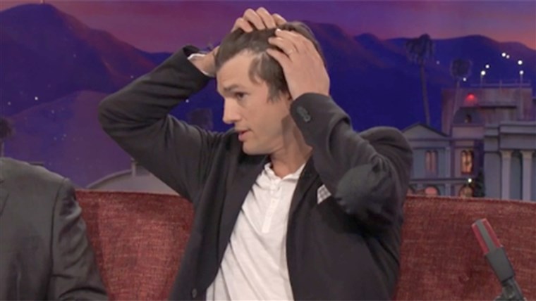 Ashton Kutcher says his hair is thinning during appearance on 