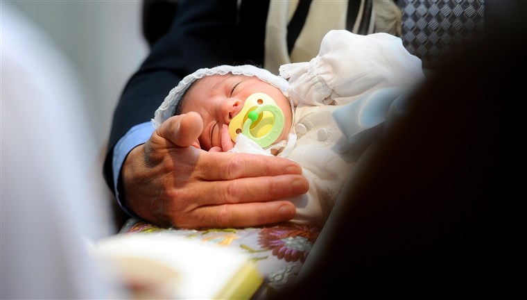 一个 newborn closes his eyes during his circumcision ceremony. The rate of circumcision in the U.S. has fallen.