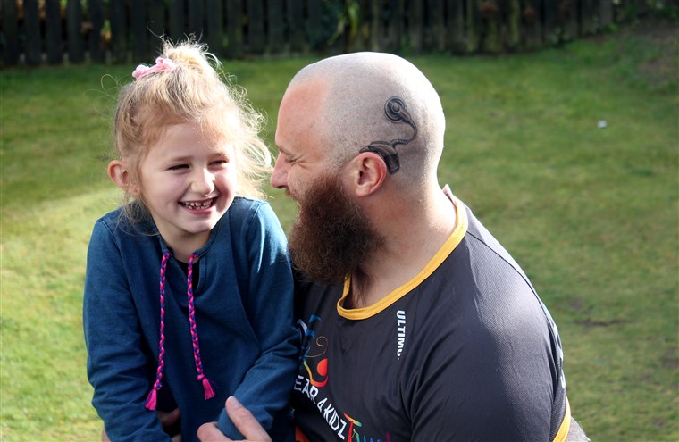 أب's cochlear implant tattoo matches the real one worn by daughter.