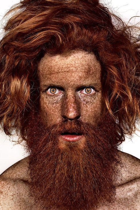شون Conway participates in photographer Brock Elbank's #Freckles series.