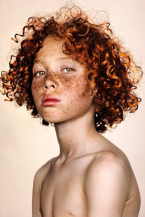 Zum his #Freckles series, photographer Brock Elbank states he's received hundreds of emails from applicants of 