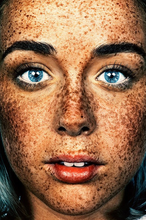 The #Freckles series began as a single image taken in 2012 by photographer Brock Elbank.