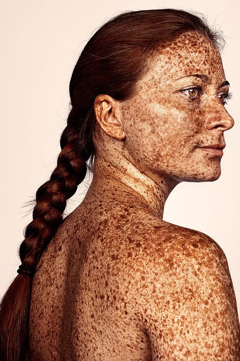 britisch photographer Brock Elbank has gone viral with his #Freckles series.