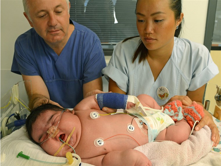 Консултант physician Matthias Knuepfer and nurse My take care of Germany's heaviest newborn until now at the neonatal intensive care ward of the Unive...