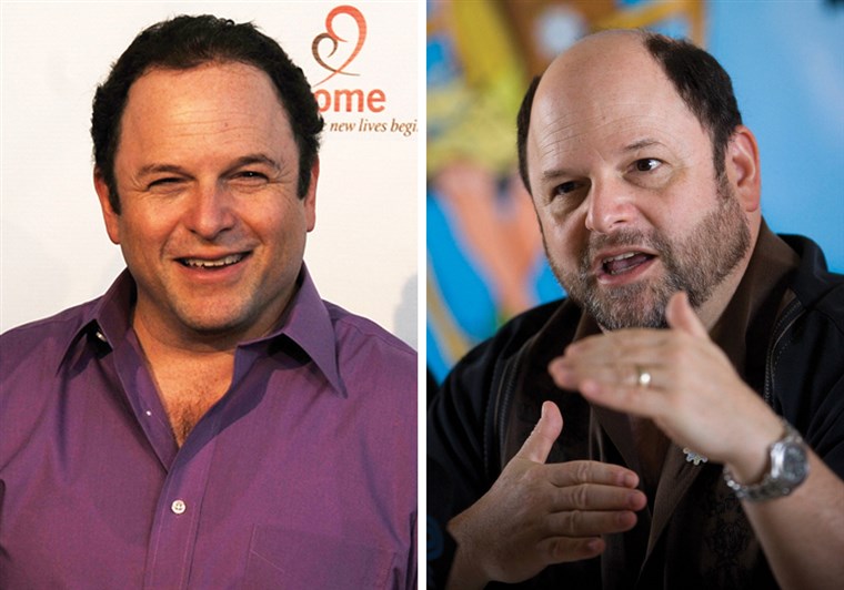 Herec Jason Alexander with hair in August, left, and in 2009, with less hair.
